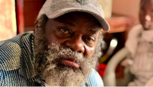 Souley onohiolo se rase enfin : l&rsquo;opération &lsquo;tomber la barbe&rsquo; prévue le 3 juillet 2026