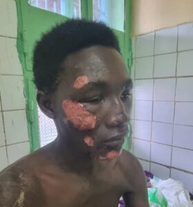 N&rsquo;djaména : une agression près du camp 27 soulève des questions sur la sécurité publique